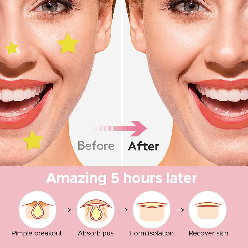 600 шт./компл., пластырь со зв – обзор и цена Beauty Makeup Tool